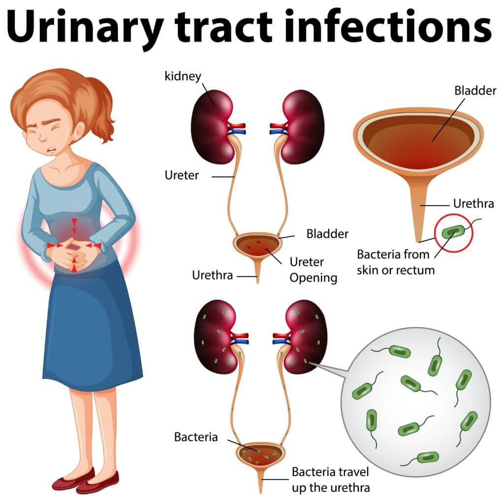 Urinary Tract Inefection