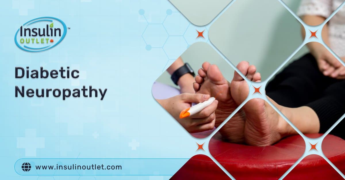 Diabetic Neuropathy