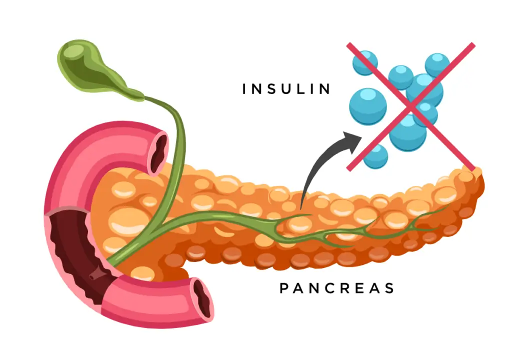 insulin-pancreas