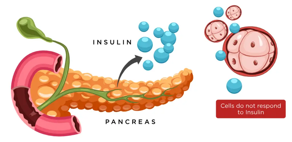 insulin-pancreas